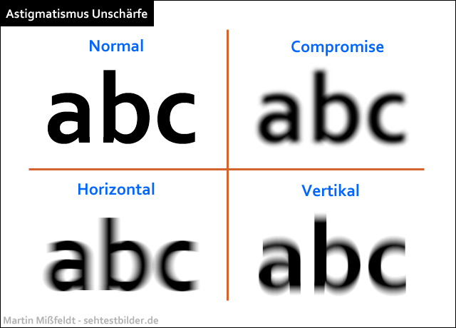 Was ist hyperopie astigmatismus, Tartalomjegyzék