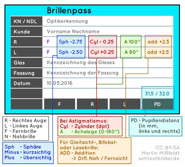 Kontaktlinse bei Kurzsichtigkeit