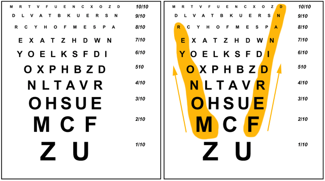 Ferdinand Monoyer Chart