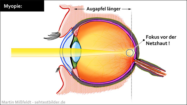 Auge Aufbau