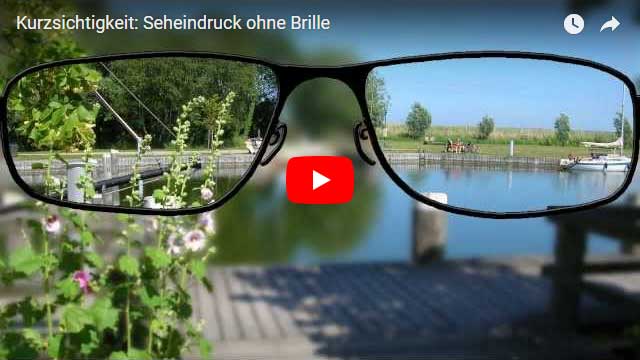 Kurzsichtigkeit - Seheindruck ohne Brille